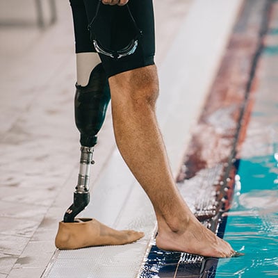 PROSTHETIC LIMBS