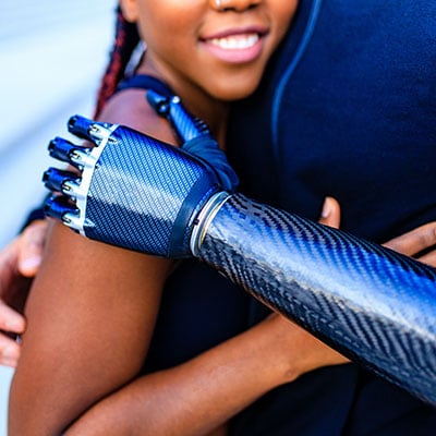 PROSTHETIC ARMS